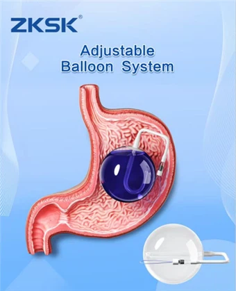 Ajustable Balloon Intragàstric Balloon Gastric Endoscòpic Globus